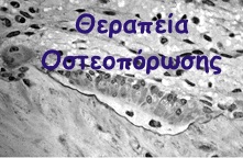 Θεραπεία οστεοπόρωσης-Treatment of osteoporosis
